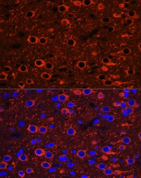 Tubulin beta 3 antibody