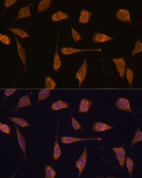 TXNRD1 antibody