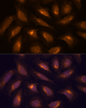 TXNRD1 antibody