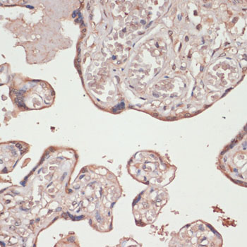 TXNRD1 antibody