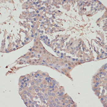 TXNRD1 antibody