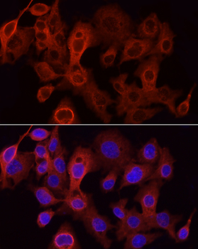 UGT1A1 antibody