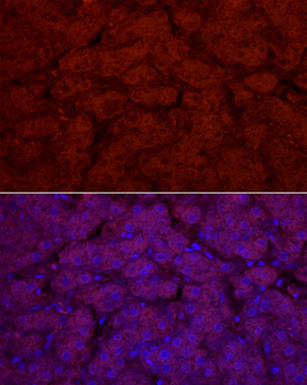 UGT1A1 antibody