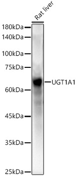 UGT1A1 antibody