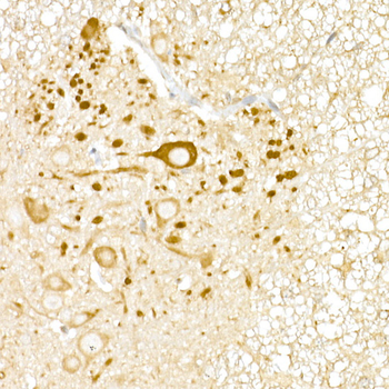 USP18 antibody