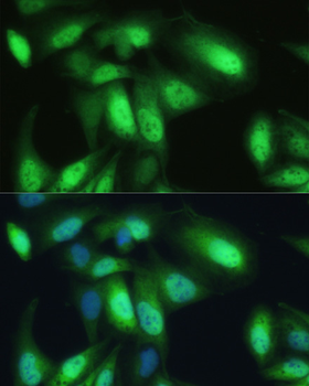 VCP antibody