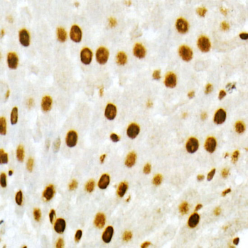 CYP27B1 antibody