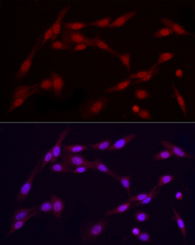 CYP27B1 antibody