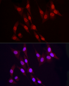 CYP27B1 antibody