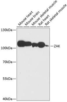 ZAK antibody