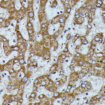 APOC3 antibody