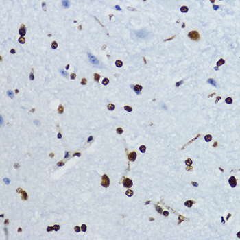 Acetyl-Histone H4-K12 antibody