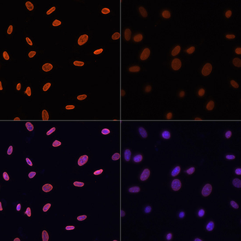 Acetyl-Histone H4-K12 antibody