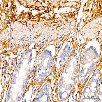 DCN antibody