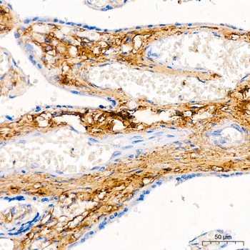 DCN antibody