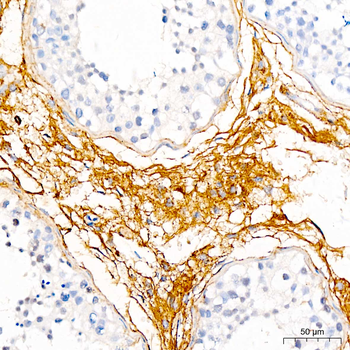 DCN antibody