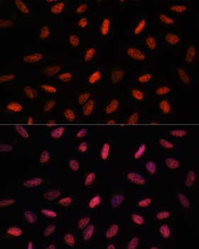 ARID1B antibody