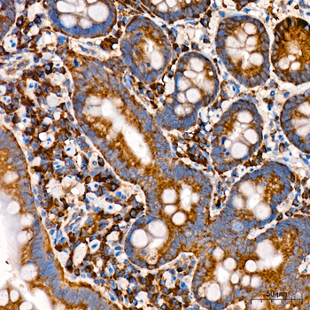 CHAC1 antibody