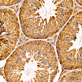 CHAC1 antibody