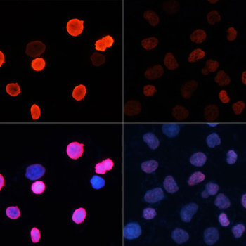 Acetyl-Histone H2B-K5 antibody