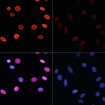 Acetyl-Histone H2B-K5 antibody