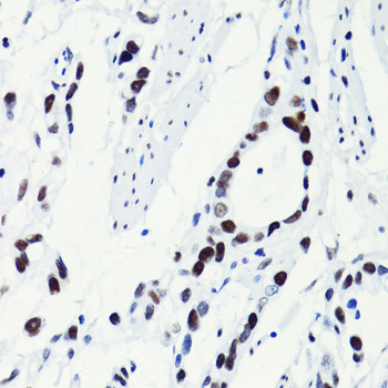 Acetyl-Histone H2B-K5 antibody