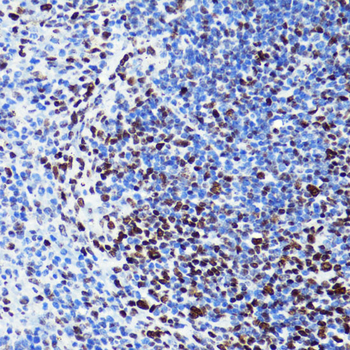 Acetyl-Histone H2B-K5 antibody