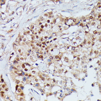 IGHMBP2 antibody