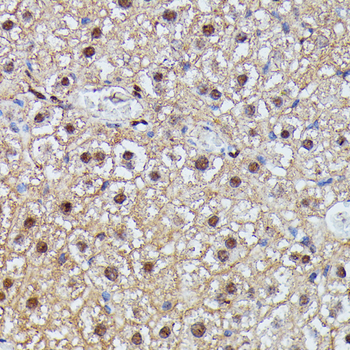 IGHMBP2 antibody