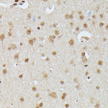 IGHMBP2 antibody