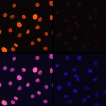 Acetyl-Histone H3-K4 antibody