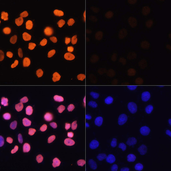 Acetyl-Histone H3-K4 antibody