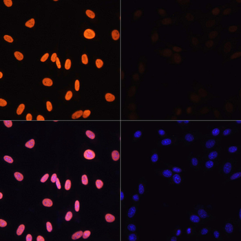 Acetyl-Histone H3-K4 antibody