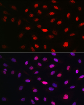 WBP11 antibody