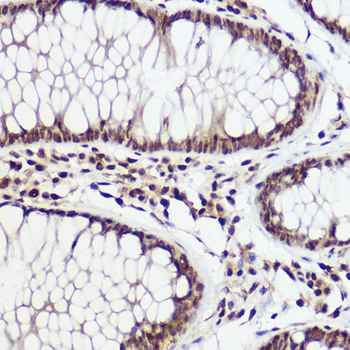 WBP11 antibody