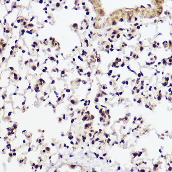 WBP11 antibody