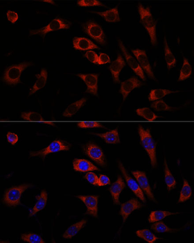 WNT10B antibody