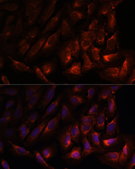 WNT10B antibody