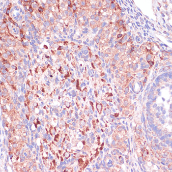 WNT10B antibody