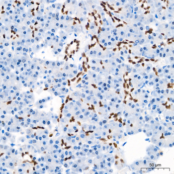 HNF1B antibody