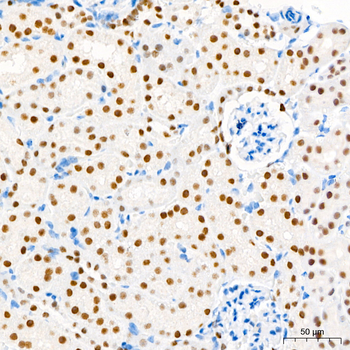 HNF1B antibody