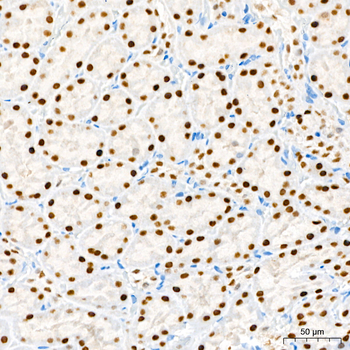 HNF1B antibody