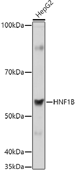 HNF1B antibody