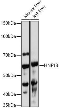 HNF1B antibody