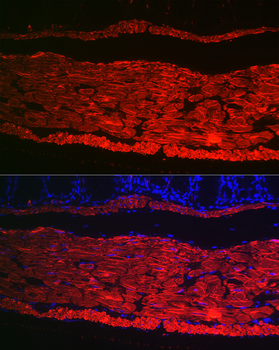 ACTA2 antibody