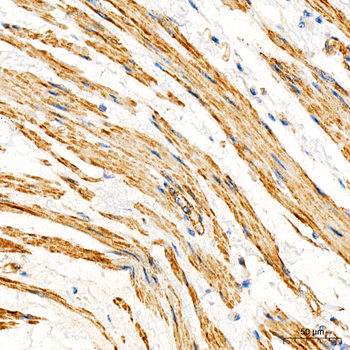 ACTA2 antibody