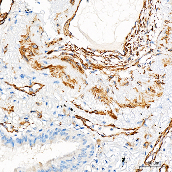 ACTA2 antibody