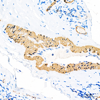 ACTA2 antibody