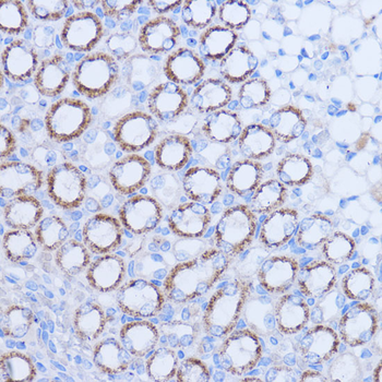 MT-ND1 antibody