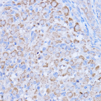 MT-ND1 antibody